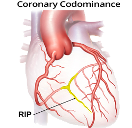 Codominant coronary artery heart