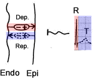 R and T wave, ventricular depolarization, repolarization, electrical vectors